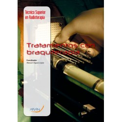 Tratamientos con braquiterapia